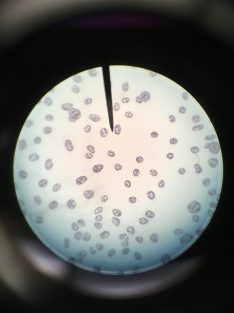 
							
								A microscope field with many cells visible. The cells have a grainy appearance with small dark stained speckles on an unstained nucleus. 
							
							